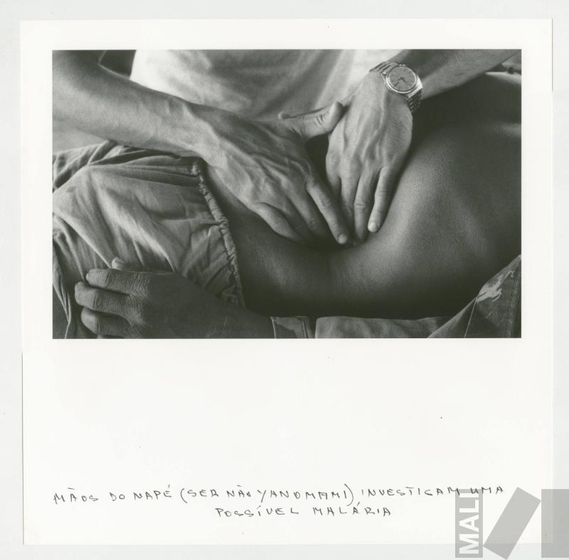 Mãos do napé (ser não Yanomami) investigam uma possível malária